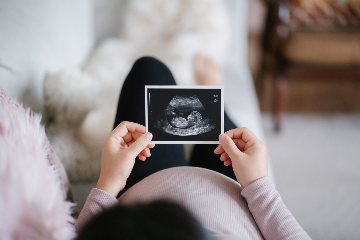 pregnant mom lying on couch holding a sonogram photo of fetus